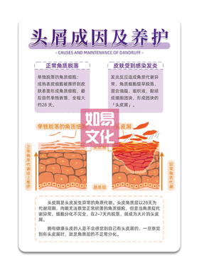 头屑成因及养护亚克力摆台