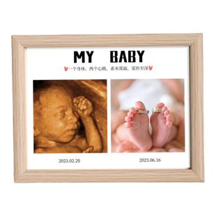 四维照片相框B超孕期宝宝彩超NT定制婴儿出生孕妇照礼物纪念摆台