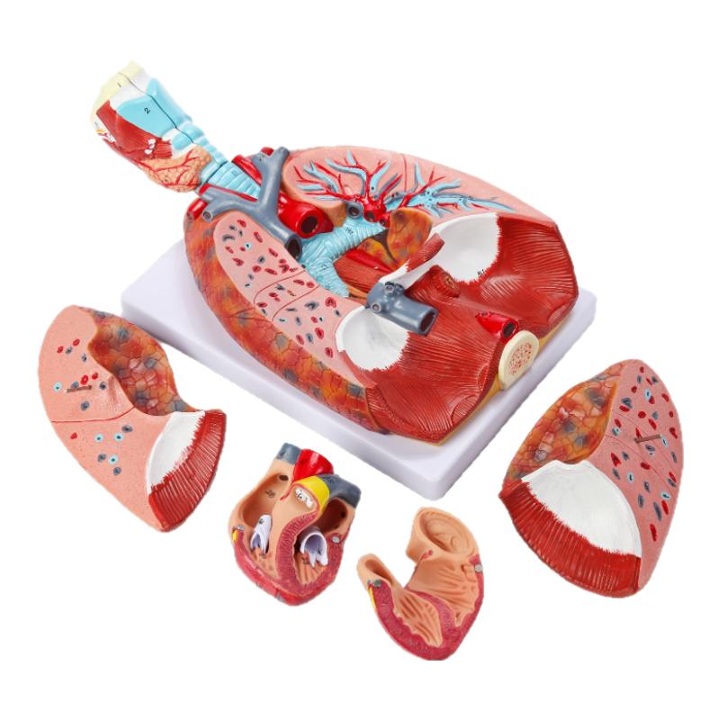 自然大人体喉心肺模型喉咙甲状腺肺心脏模型呼吸系统肺部内脏解剖