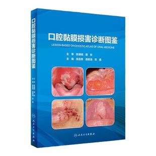 口腔黏膜损害诊断图鉴病图谱学牙周手术上颌窦黏膜病变牙髓之路根管治疗临床鉴别颌面外科种植精准植入技巧科学规范化人卫医学书籍