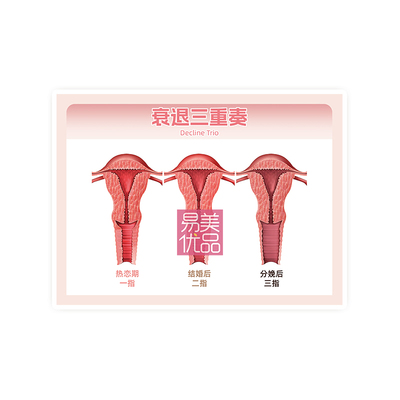 妇科宫颈私处疾病子宫生殖变化解剖图谱产康私密宣传纸页塑封医美