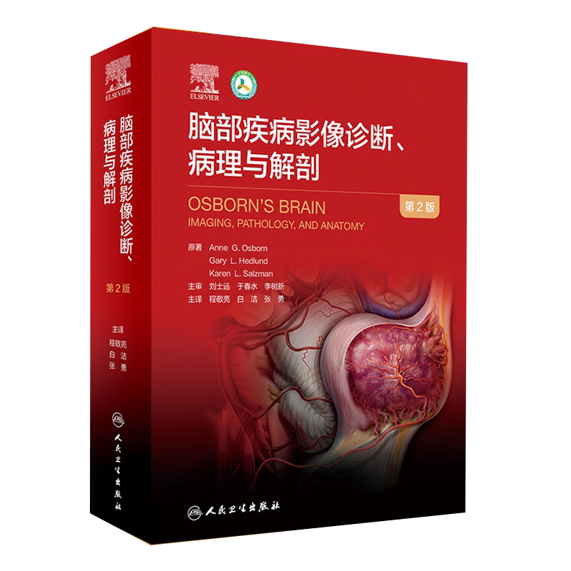 脑部疾病解剖影像诊断翻译