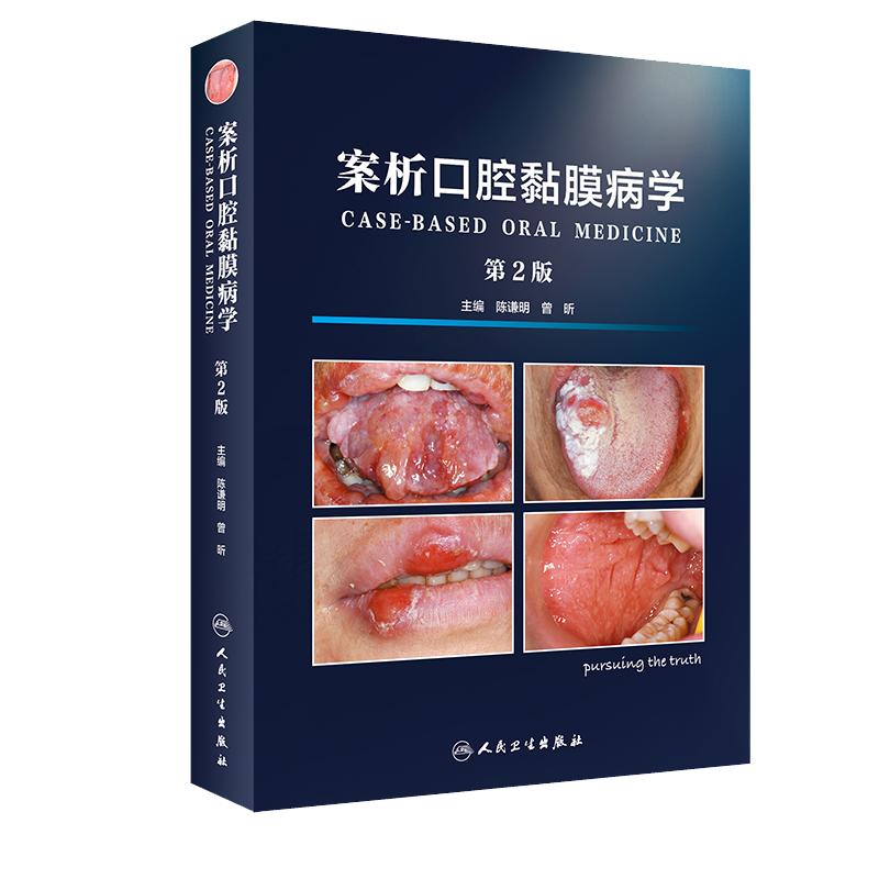案析口腔黏膜病学 版 第2版 牙周纤维化膜龈美学手术精要手术临床实用牙周组织健康引导治疗与种植体周手术 人民卫生出版社
