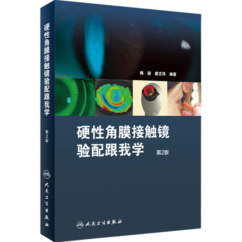 硬性角膜接触镜验配跟我学第二