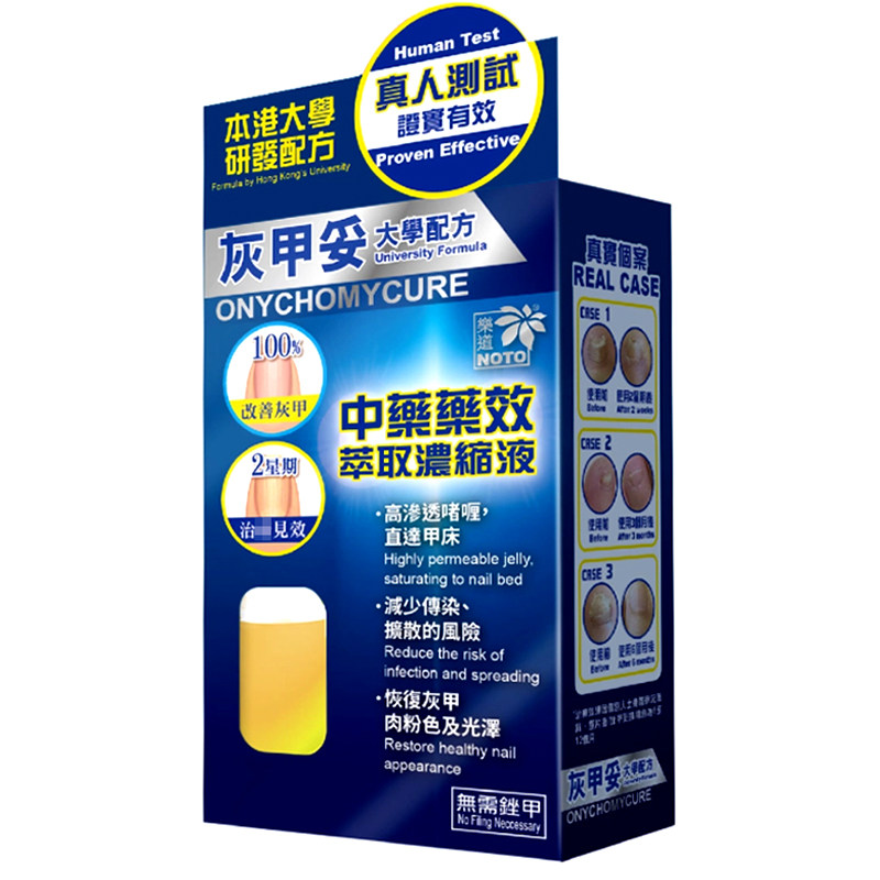 香港乐道灰甲妥灰指甲液大学配方