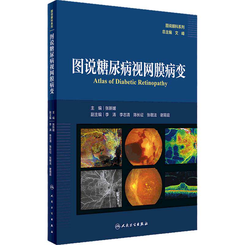 图说糖尿病视网膜病变图说眼科系列张新媛人民卫生出版社视网膜血管疾病青光眼白内障玻璃体视神经内分泌科OCT并发症眼科学影像