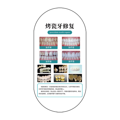 牙科诊所亚克力透明上墙定制牌