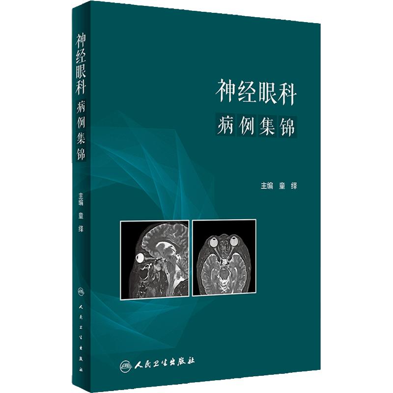 神经眼科病例集锦 童绎 主编 两条及以上脑神经麻痹 特殊类型的眼球运动异常和斜视等 人民卫生出版社 9787117348188