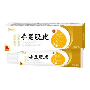 手脱皮严重脱皮专用药膏手指干裂蜕皮真菌感染干燥起皮皲裂护手霜
