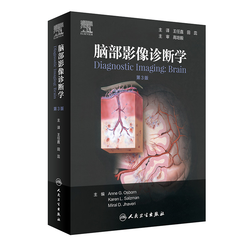 脑部影像诊断学第二2版 王任直田蕊脑部畸形中毒代谢性疾病创伤感染神经头颈内外科超声核磁共振ct人民卫生出版社医学影像学书籍