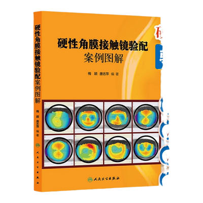 硬性角膜接触镜验配案例图解梅颖