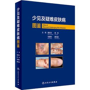少见及疑难皮肤病图鉴 高天文 西京皮肤医院病理诊断少见疾病临床错诊修正非典型病例中高职医生学习教材人民卫生出版社皮肤科临床
