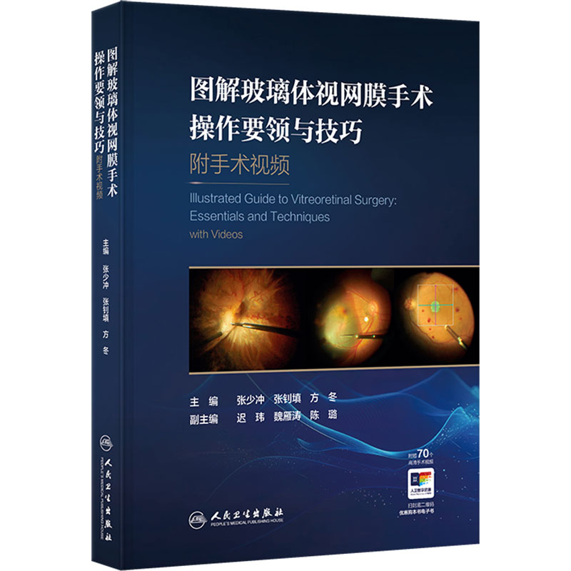 图解玻璃体视网膜手术操作要领与技巧附手术视频张少冲微创联合白内障手术眼科学人民卫生出版社医学专著