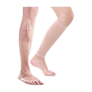 中三院静脉曲张医用弹力袜防血栓二级治疗型术后压力袜男女孕妇