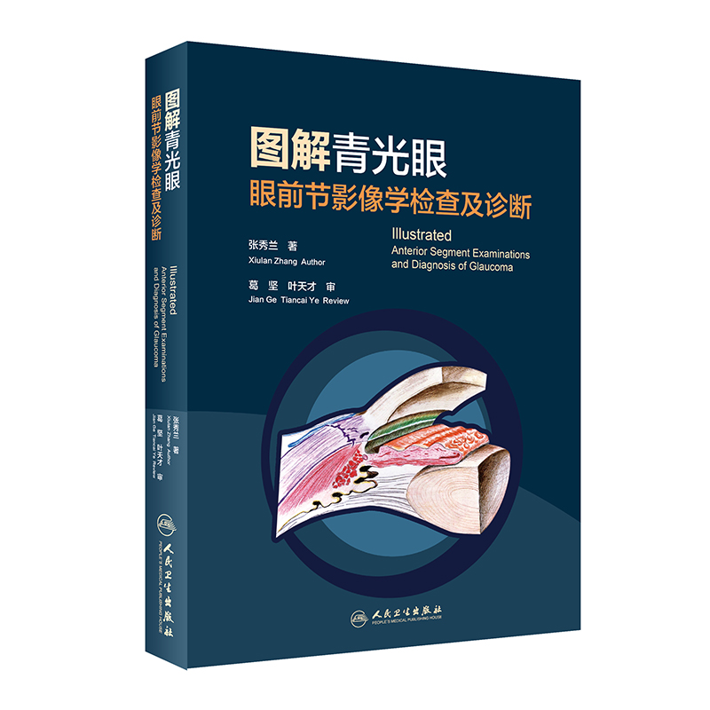 图解青光眼 眼前节影像学检查及诊断张秀兰眼科疾病临床案例诊治教程眼科学房角镜oct裂隙灯显微镜玻璃体角膜屈光视网膜病变工具书