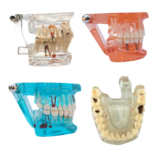 口腔模型牙齿模型幼儿园教具儿童刷牙玩具牙齿牙科模型假牙模型