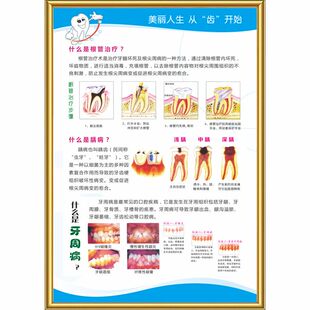 牙科挂图知识宣传画口腔诊所烤瓷牙解剖图海报规章制度KT板定制