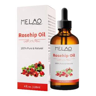 Melao玫瑰果油面部按摩精油补水保湿护肤美肤油焕亮肤色精华液女i