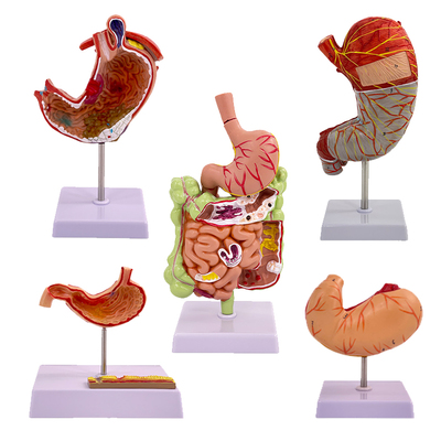 蓝蝶模型消化科胃病理器官教学