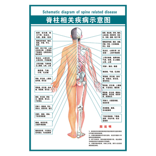 人体脊柱相关疾病示意图中医养生脊椎病理原因结构图挂图海报挂画