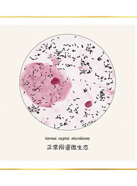 妇科阴道微生态健康宣传挂画月子中心医院妇产科诊室私密保养壁画