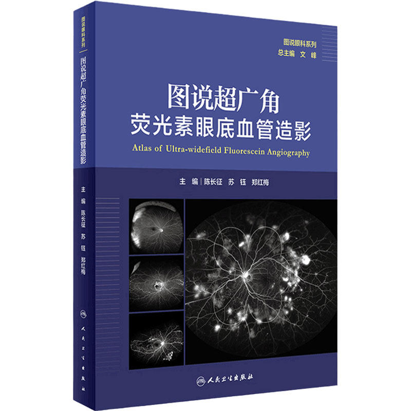 图说超广角荧光素眼底血管造影 人卫图说眼科系列陈长征苏钰郑红梅主编人民卫生出版社OCT眼底病检查技术OCTA视网膜眼科医学类书籍