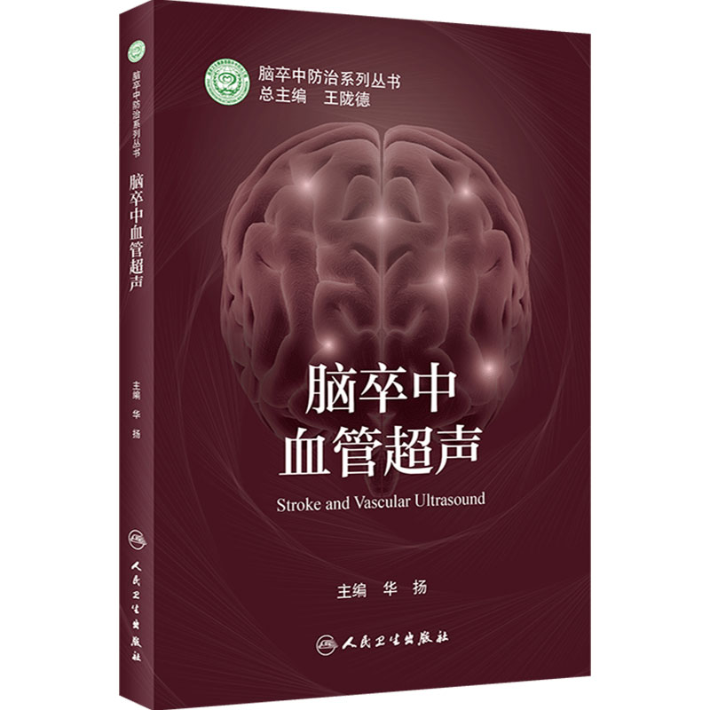 脑卒中脑卒中血管超声