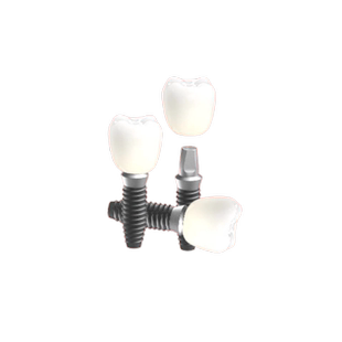 拜博口腔 登腾韩国种植牙补牙镶牙基台口腔假牙种牙