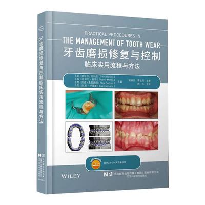 牙齿磨损修复与控制辽宁科学技术