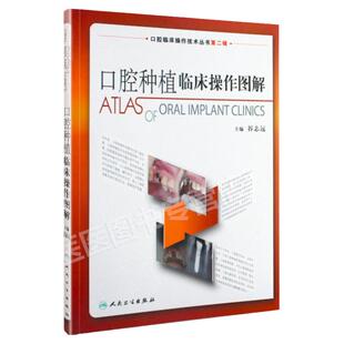 正版 口腔种植临床操作图解 拔牙技巧学义齿全瓷修复颌面外科正畸黏膜病学牙髓之路儿童牙科病历根管治疗口腔医学书籍