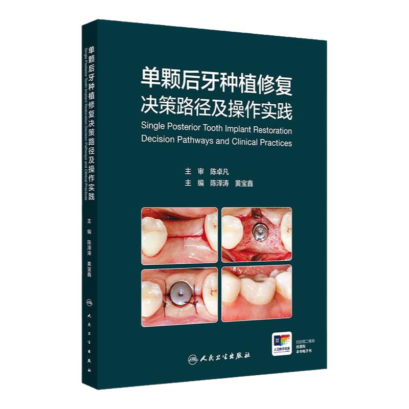 单颗后牙种植修复决策路径及操作实践人卫儿童二期戴种植冠搭并发症满毅精准植入技巧规范化治疗清单根管牙周拔牙牙科护理口腔书籍