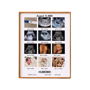 孕期B超四维彩超宫格相框摆台定制diy宝宝婴儿满月百天照片礼物