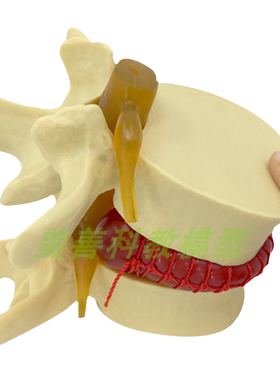 美善模型腰椎间盘教学骨骼演示