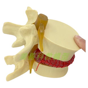 教学人体脊柱模型脊椎骨头腰椎间盘模具椎体突出受压病理骨质教具
