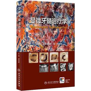 显微牙髓治疗学第2版凌均棨牙科口腔全科医师牙体牙髓专科医师数字化多学科诊疗牙齿牙髓病病例精粹视频增值锥形束CT根管治疗图谱
