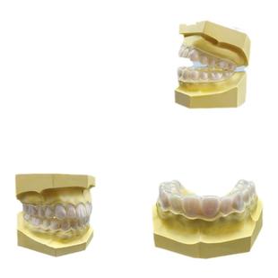 夜间防磨牙牙套定制成人儿童睡觉咬合板夜磨牙垫颌垫护齿神器大人