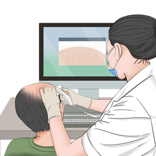 碧莲盛不剃发植发 毛囊检测 男女头皮毛囊状况检测脱发掉发分析