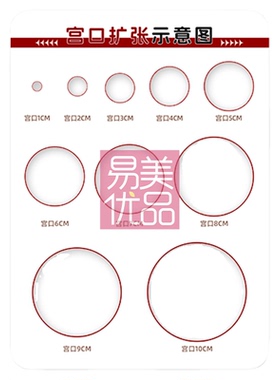 宫口扩张示意图摆台亚克力展示牌