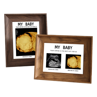 四维彩超相框宝宝B超装裱孕期婴儿成长纪念摆台出生照片礼物定制