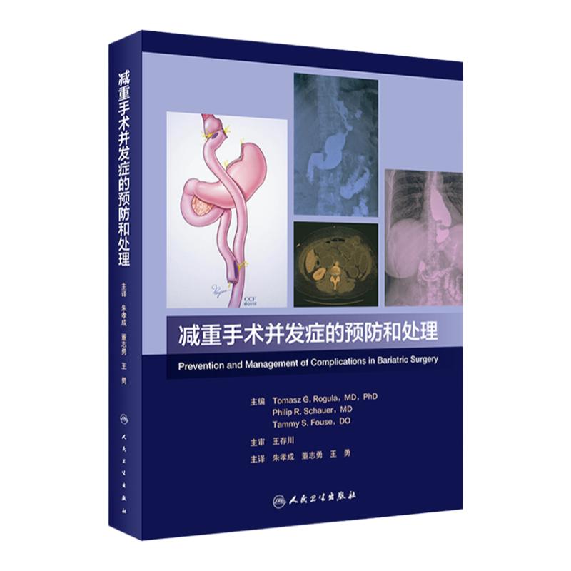 减重手术并发症的预防和处理减肥抽脂整形减重胃旁路手术技能不良