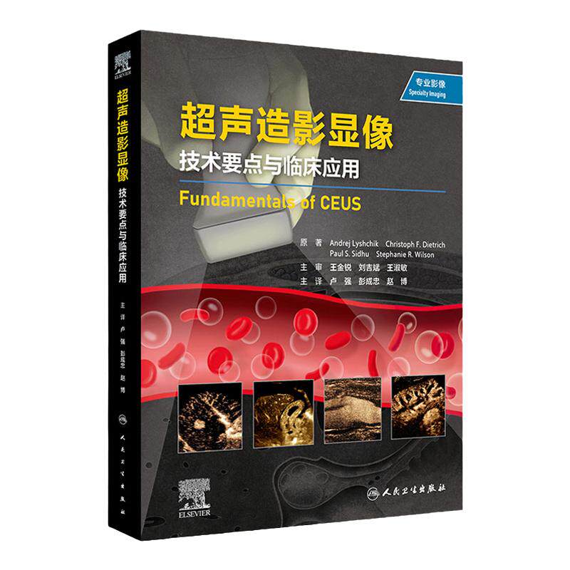 超声造影显像 技术要点与临床应用 超过1000张高质量的图片 配有说明和注释 丰富的病例能帮助读者充分了解增强超声的独特优势