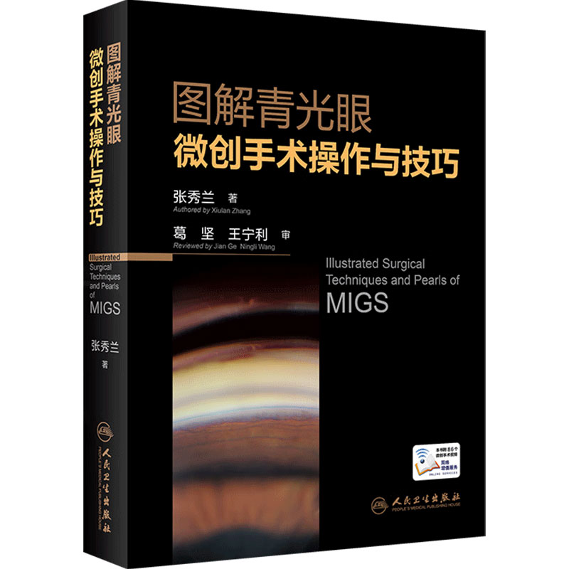 图解青光眼微创手术操作与技巧
