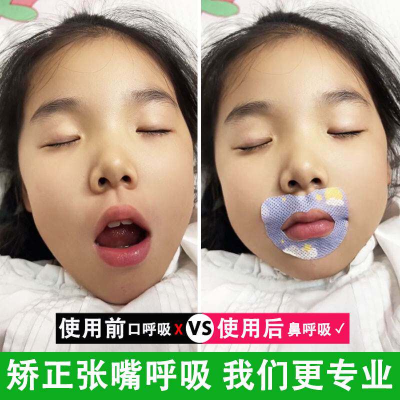 呼吸矫正神器新闭嘴贴儿童封口贴防张嘴睡觉防打呼噜防龅牙嘴巴贴