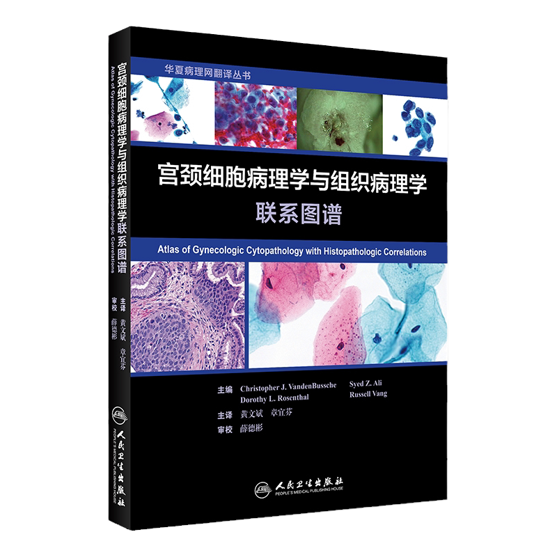 宫颈细胞病理学与组织病理学联系图谱 本书除了介绍正常宫颈感染性疾病等细胞学特征外还专门介绍了各种宫颈病变的阴道镜检查结果