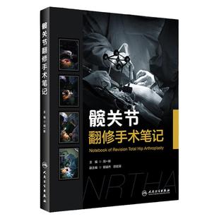 髋关节翻修手术笔记 周一新 人工髋关节置换手术实用外科学手术学骨折关节重建技术书籍临床外科翻修术 人民卫生出版社