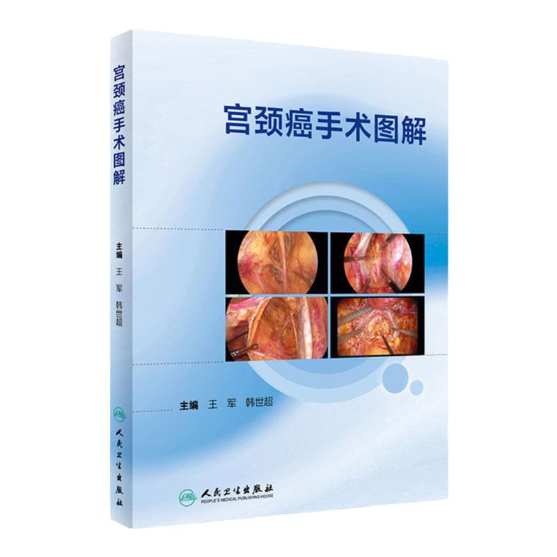 宫颈癌手术图解妇产科学人卫