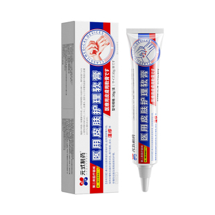 顽固牛皮癣银屑病专用真菌感染皮肤癣痒麻疹止痒角化型手癣特效膏