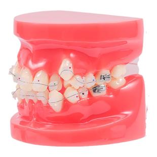牙齿模型口腔教学摆件口腔医患沟通练习正畸托槽可拆卸全口牙模