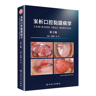 正版 案析口腔黏膜病学 第二版 第2版牙周纤维化膜龈美学手术精要手术临床实用牙周组织健康引导治疗与种植体周手术人民卫生出版社