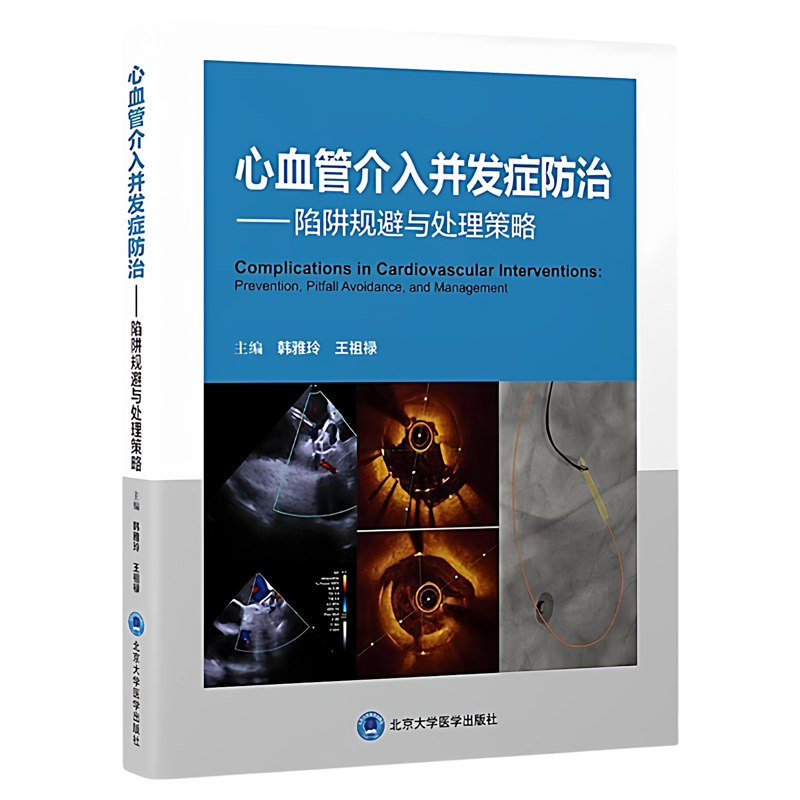 心血管介入并发症防治陷阱规避